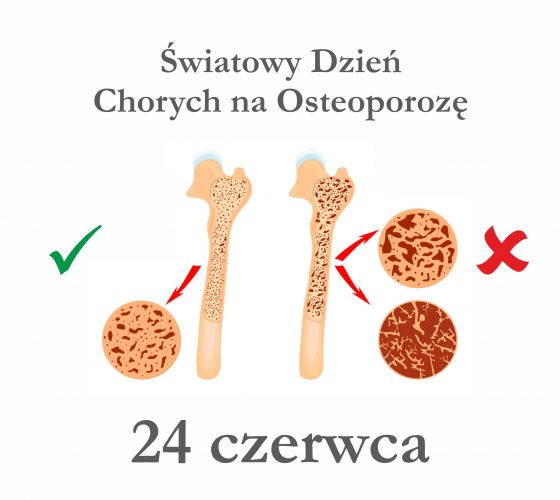 24 czerwca - Światowy Dzień Chorych na Osteoporozę